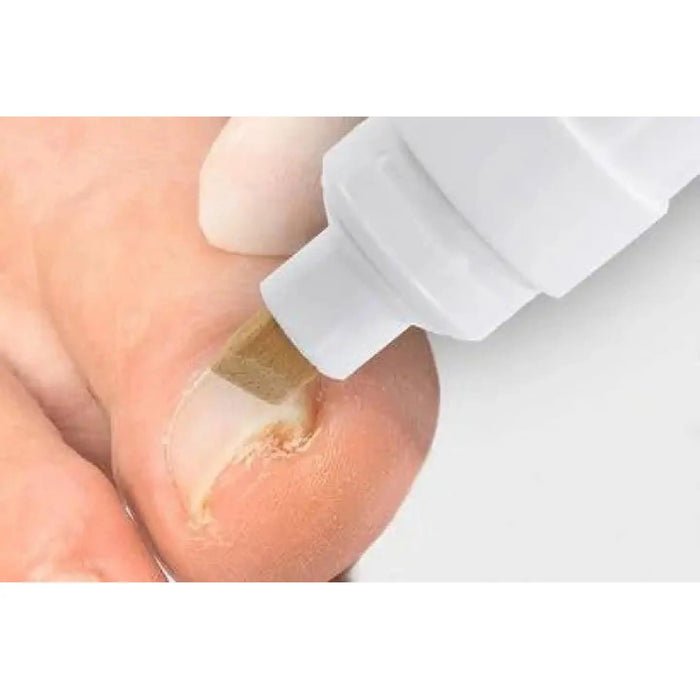 Aktivator B/S pen - Nail preparation - 8 ml - My Podologie