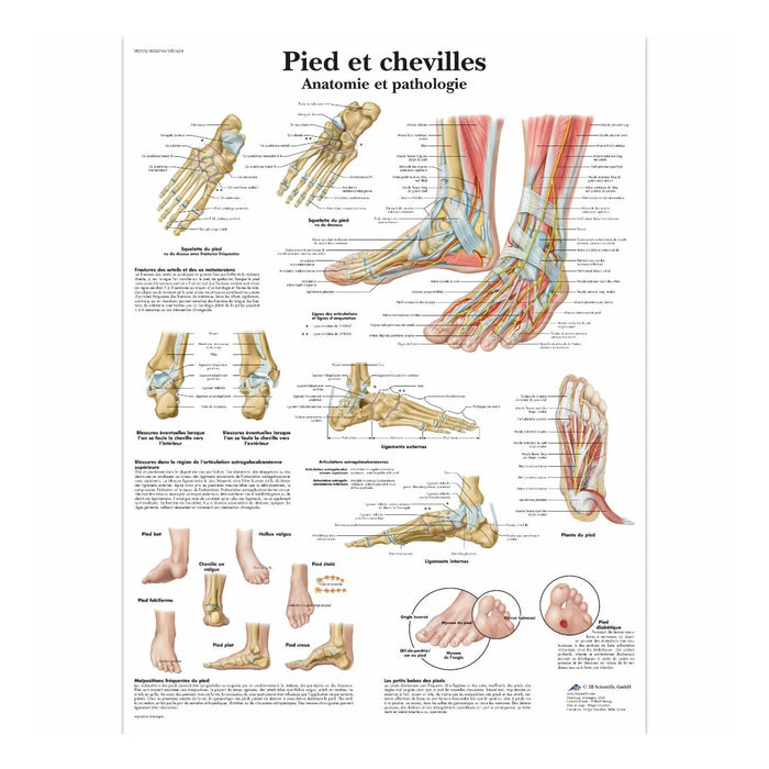 Anatomical board - Foot and ankles - Anatomy and pathology 3B Scientific