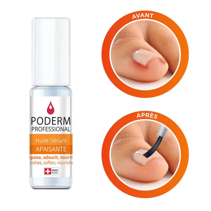 Ingrown, encrusted nail serum treatment - 8ml - Soothing - Poderm Professional - My Podologie