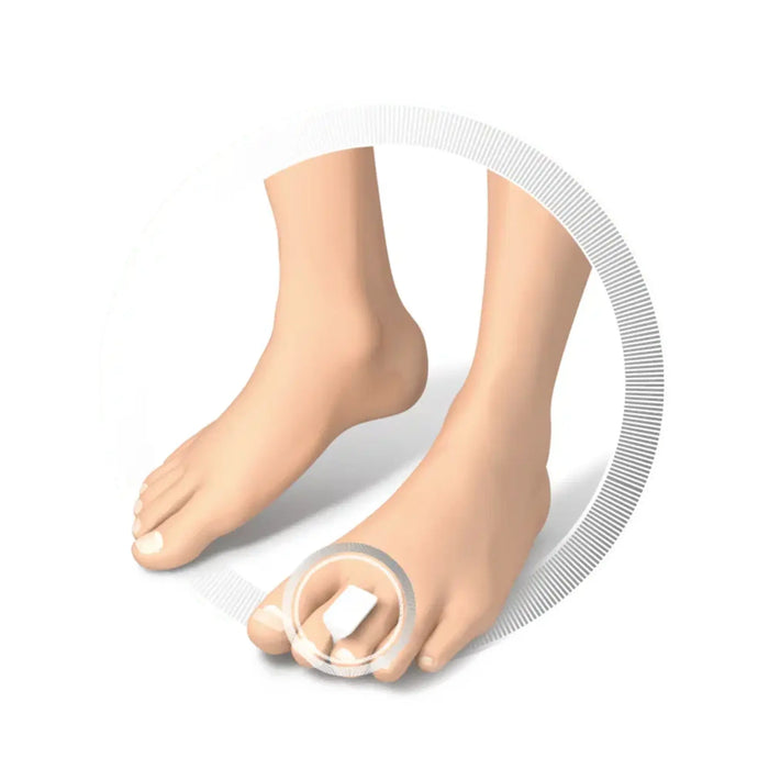 Soft Foam Toe Protector - 35 x 42 x 22 mm - 2 Pieces - Ruck Ruck